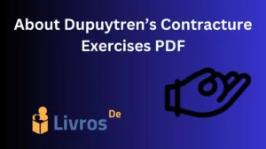 Dupuytren Contracture Physical therapy Exercises